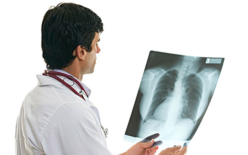 为何肺癌发现时已经中晚期？