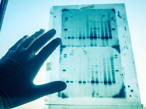 Nature新闻：4%的生物医学论文存在图片重复
