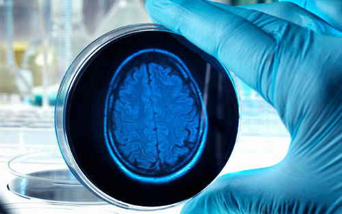 Cell Stem Cell：操纵PTEN基因培养出具有表面褶皱的大脑类器官